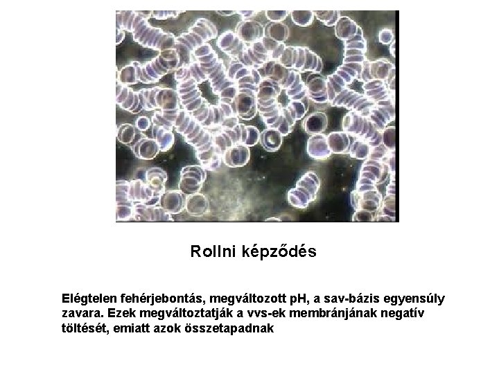 Rollni képződés Elégtelen fehérjebontás, megváltozott p. H, a sav-bázis egyensúly zavara. Ezek megváltoztatják a Rollni képződés Elégtelen fehérjebontás, megváltozott p. H, a sav-bázis egyensúly zavara. Ezek megváltoztatják a