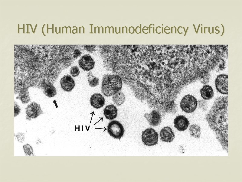 HIV (Human Immunodeficiency Virus) 