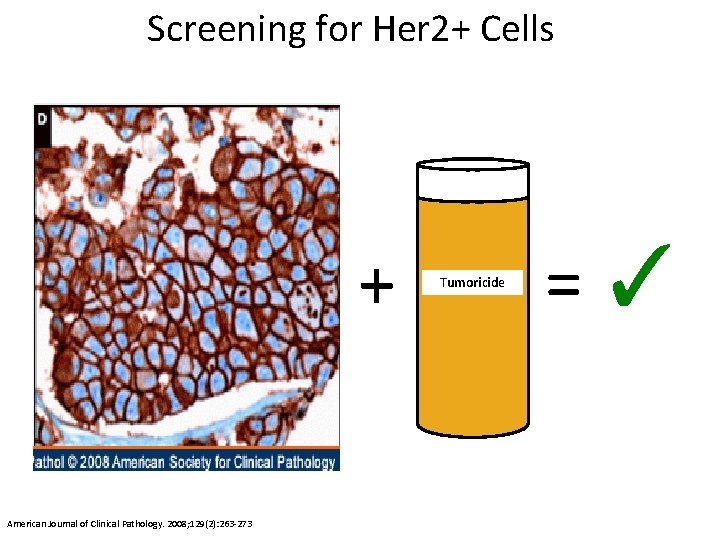 Screening for Her 2+ Cells + American Journal of Clinical Pathology. 2008; 129(2): 263