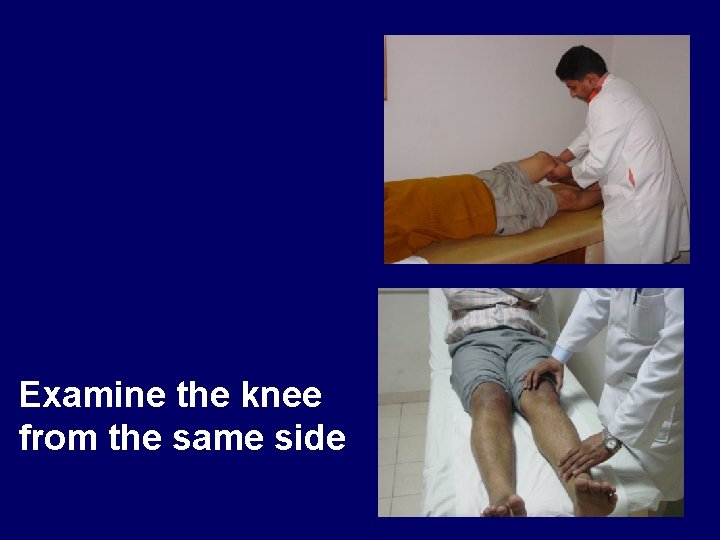 Examine the knee from the same side 