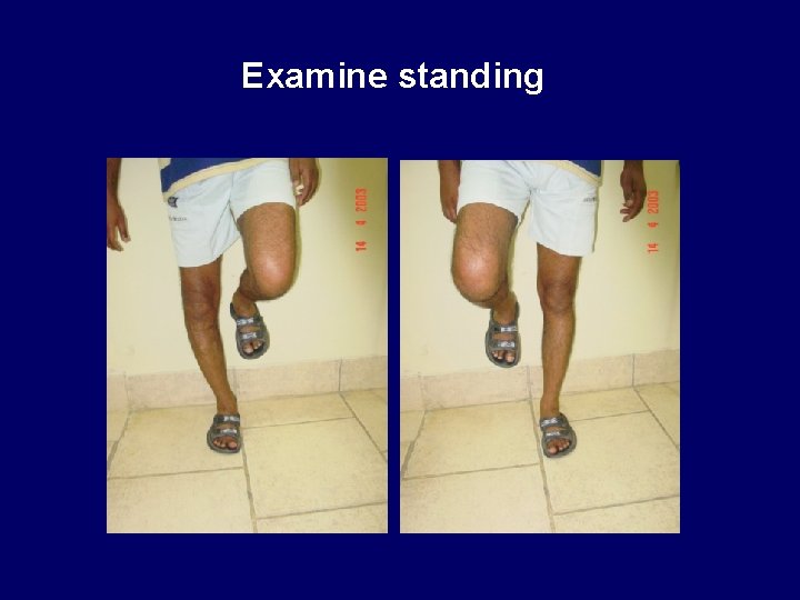 Examine standing 