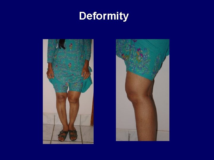 Deformity 