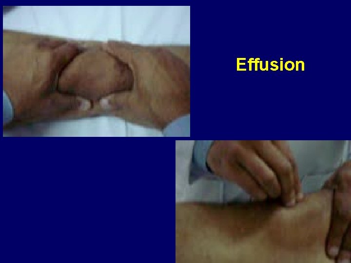 Effusion 