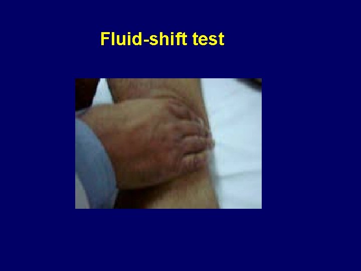 Fluid-shift test 