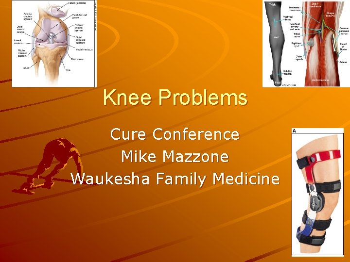 Knee Problems Cure Conference Mike Mazzone Waukesha Family Medicine 