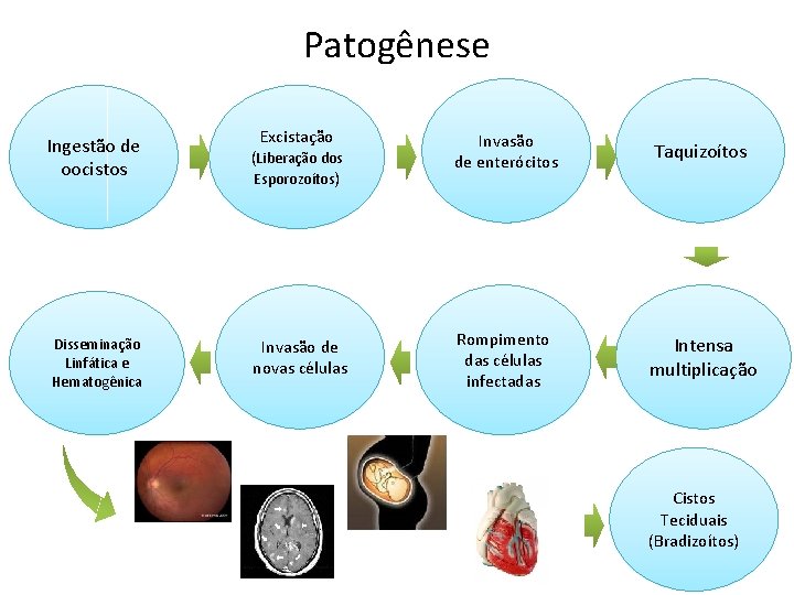 Patogênese Ingestão de oocistos Disseminação Linfática e Hematogênica Excistação Invasão de enterócitos Taquizoítos Invasão