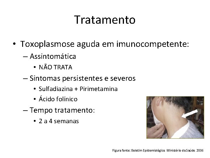 Tratamento • Toxoplasmose aguda em imunocompetente: – Assintomática • NÃO TRATA – Sintomas persistentes