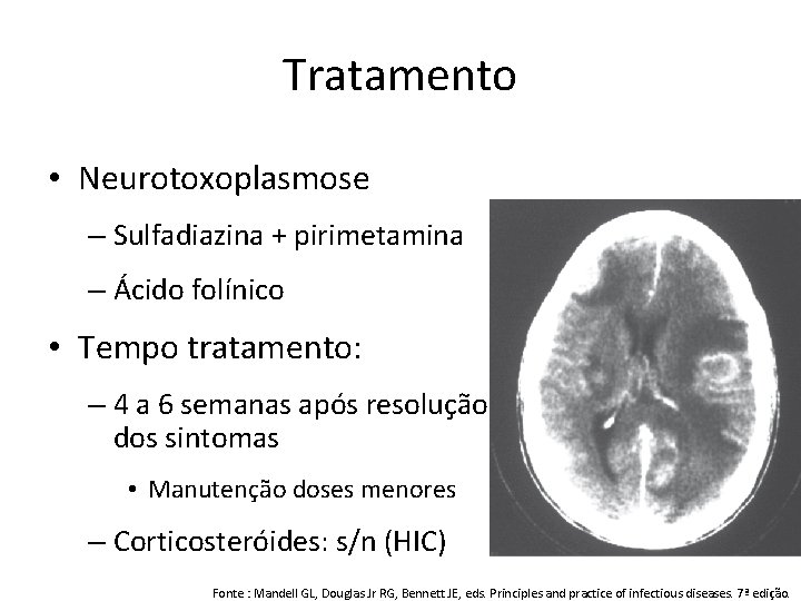 Tratamento • Neurotoxoplasmose – Sulfadiazina + pirimetamina – Ácido folínico • Tempo tratamento: –