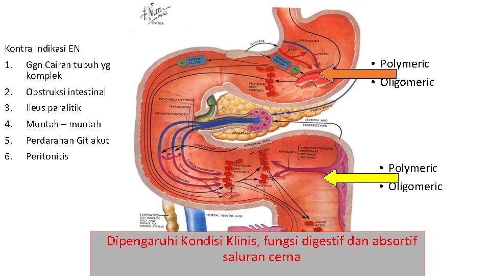 Kontra Indikasi EN 1. Ggn Cairan tubuh yg komplek 2. Obstruksi intestinal 3. Ileus Kontra Indikasi EN 1. Ggn Cairan tubuh yg komplek 2. Obstruksi intestinal 3. Ileus