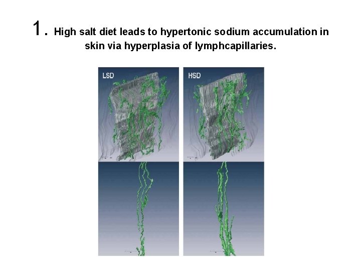 1. High salt diet leads to hypertonic sodium accumulation in skin via hyperplasia of