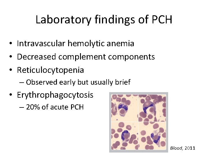 Laboratory findings of PCH • Intravascular hemolytic anemia • Decreased complement components • Reticulocytopenia
