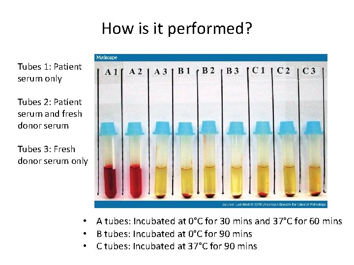 How is it performed? Tubes 1: Patient serum only Tubes 2: Patient serum and