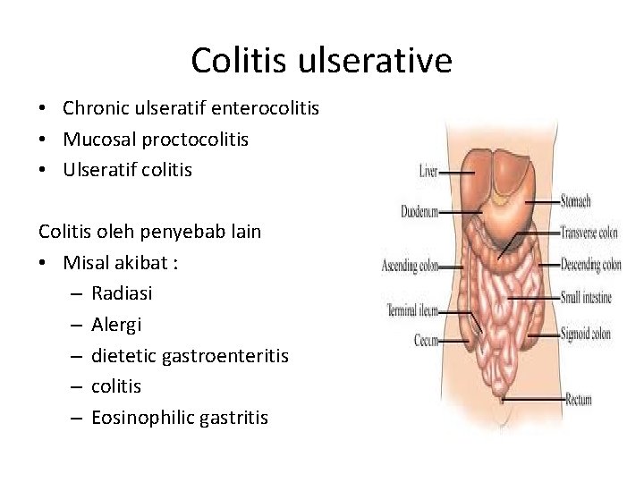 Colitis ulserative • Chronic ulseratif enterocolitis • Mucosal proctocolitis • Ulseratif colitis Colitis oleh