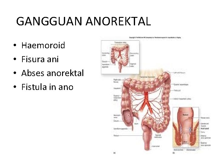 GANGGUAN ANOREKTAL • • Haemoroid Fisura ani Abses anorektal Fistula in ano 