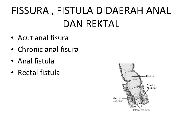 FISSURA , FISTULA DIDAERAH ANAL DAN REKTAL • • Acut anal fisura Chronic anal