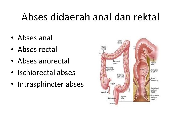 Abses didaerah anal dan rektal • • • Abses anal Abses rectal Abses anorectal