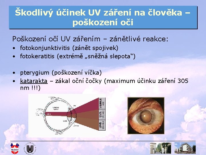 Škodlivý účinek UV záření na člověka – poškození oči Poškození očí UV zářením –