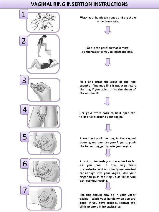 VAGINAL RING INSERTION INSTRUCTIONS 1 2 3 4 5 6 7 Wash your hands