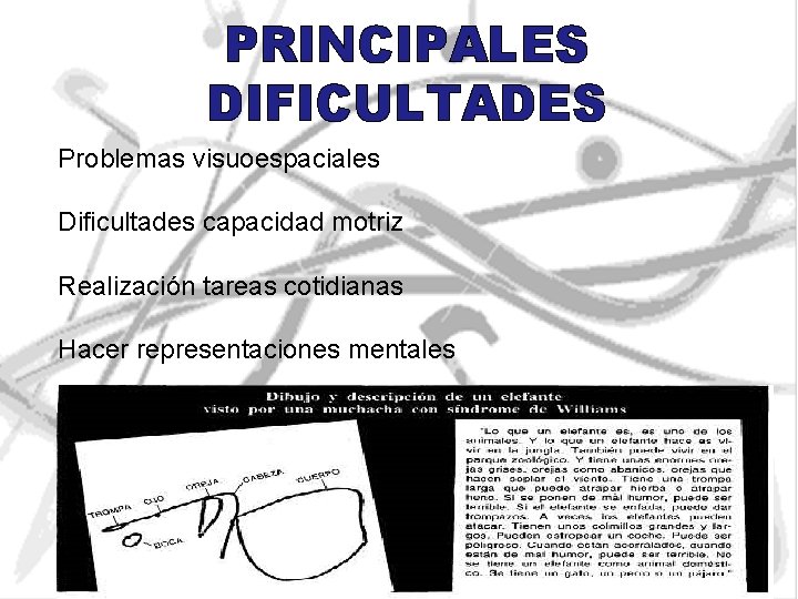 PRINCIPALES DIFICULTADES Problemas visuoespaciales Dificultades capacidad motriz Realización tareas cotidianas Hacer representaciones mentales 