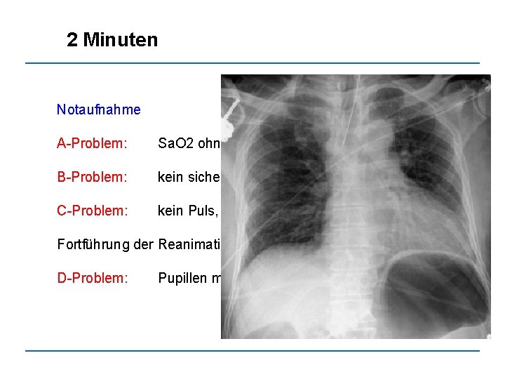 2 Minuten Notaufnahme A-Problem: Sa. O 2 ohne Signal B-Problem: kein sicheres Atemgeräusch C-Problem: