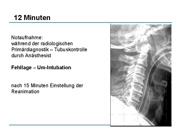 12 Minuten Notaufnahme: während der radiologischen Primärdiagnostik – Tubuskontrolle durch Anästhesist Fehllage – Um-Intubation