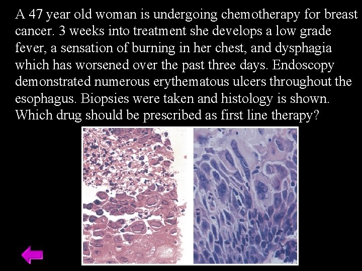 A 47 year old woman is undergoing chemotherapy for breast cancer. 3 weeks into