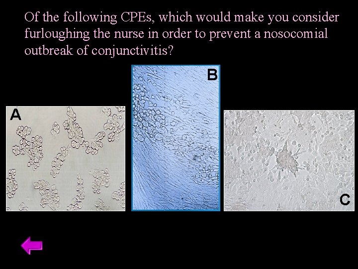 Of the following CPEs, which would make you consider furloughing the nurse in order Of the following CPEs, which would make you consider furloughing the nurse in order