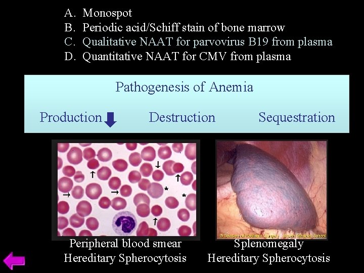 A. B. C. D. Monospot Periodic acid/Schiff stain of bone marrow Qualitative NAAT for