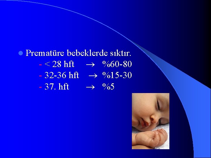 l Prematüre bebeklerde sıktır. - < 28 hft %60 -80 - 32 -36 hft