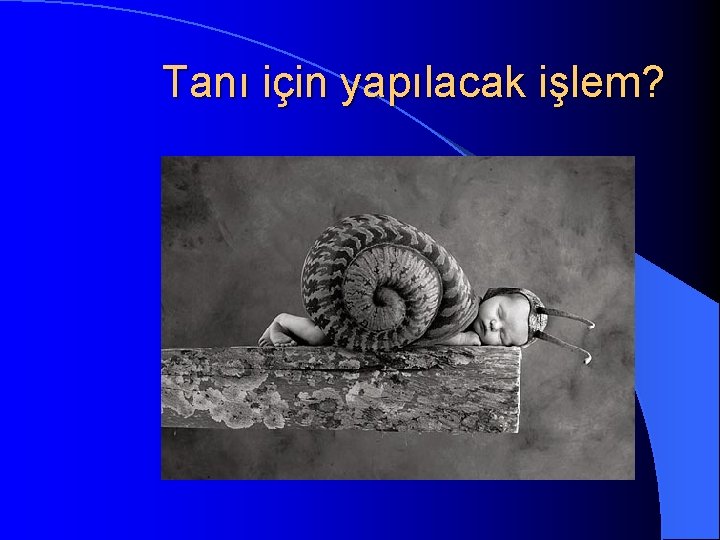 Tanı için yapılacak işlem? 