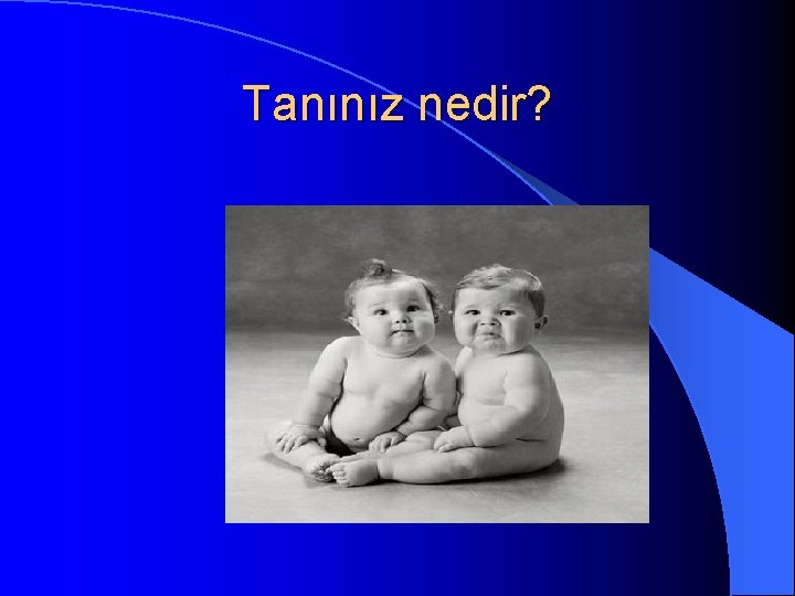 Tanınız nedir? 