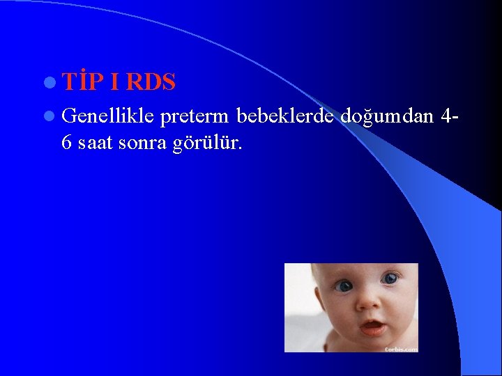 l TİP I RDS l Genellikle preterm bebeklerde doğumdan 46 saat sonra görülür. 