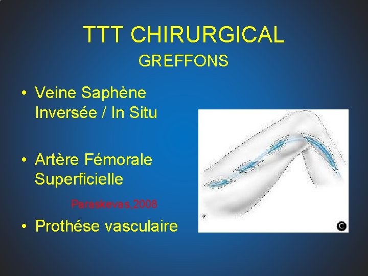 TTT CHIRURGICAL GREFFONS • Veine Saphène Inversée / In Situ • Artère Fémorale Superficielle