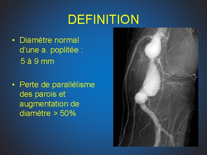 DEFINITION • Diamètre normal d’une a. poplitée : 5 à 9 mm • Perte