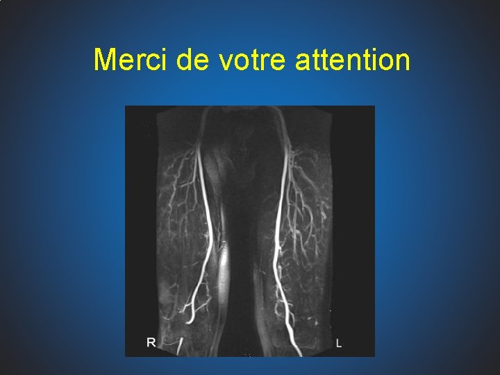 Merci de votre attention 