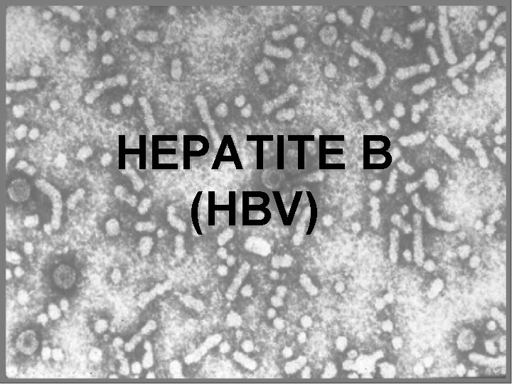 HEPATITE B (HBV) 