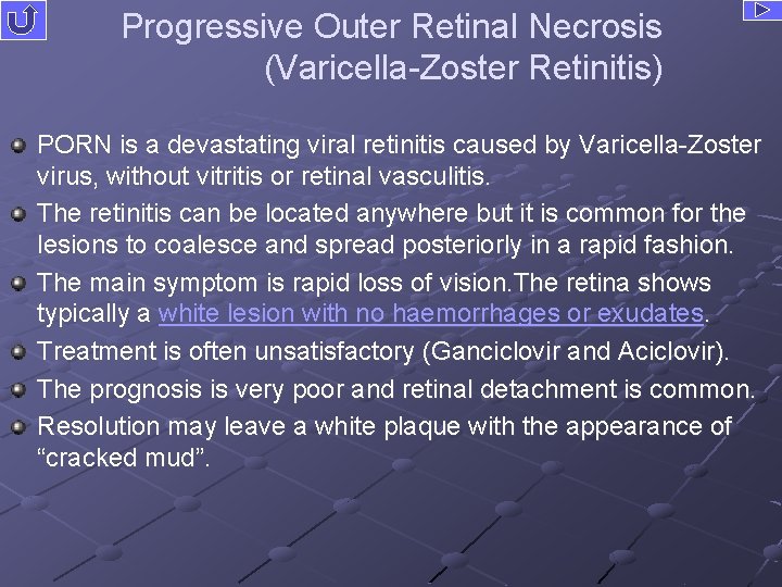 Progressive Outer Retinal Necrosis (Varicella-Zoster Retinitis) PORN is a devastating viral retinitis caused by