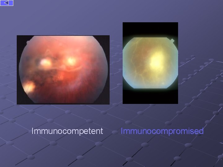 Immunocompetent Immunocompromised 