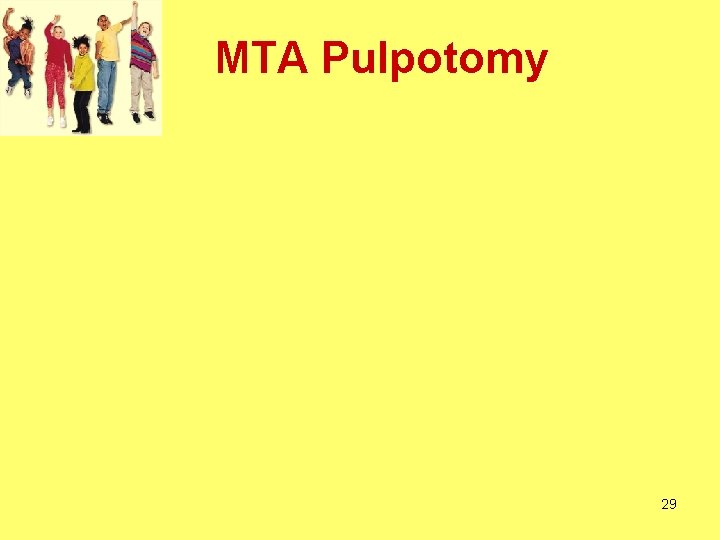 MTA Pulpotomy 29 MTA Pulpotomy 29
