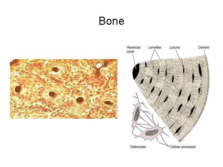 Bone 