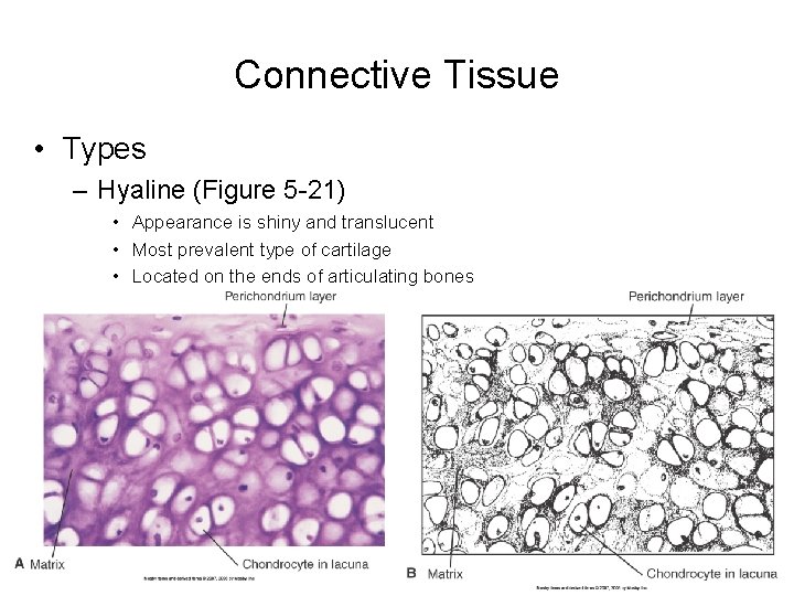 Connective Tissue • Types – Hyaline (Figure 5 -21) • Appearance is shiny and