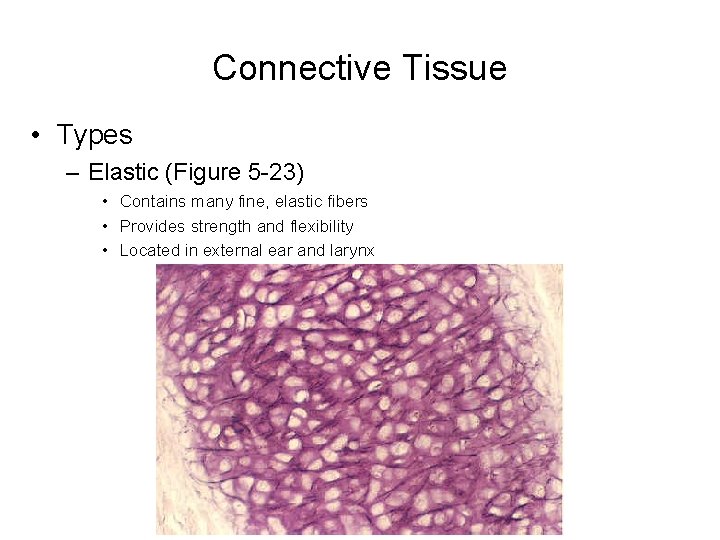 Connective Tissue • Types – Elastic (Figure 5 -23) • Contains many fine, elastic