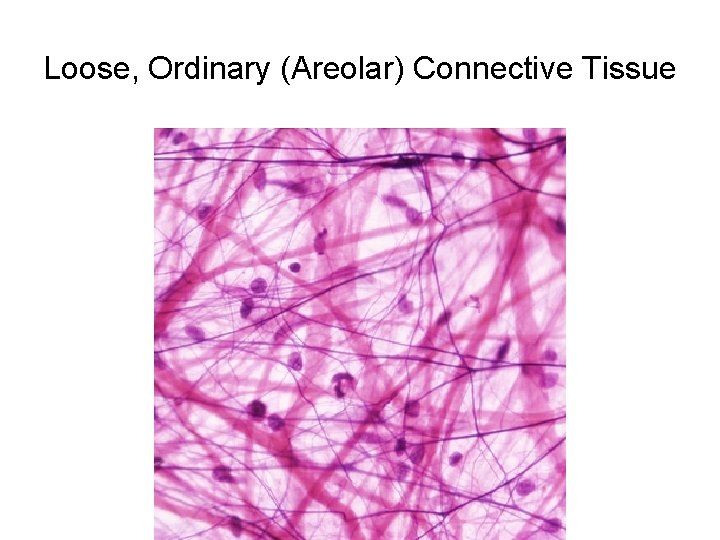 Loose, Ordinary (Areolar) Connective Tissue 