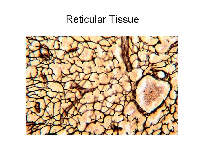 Reticular Tissue 