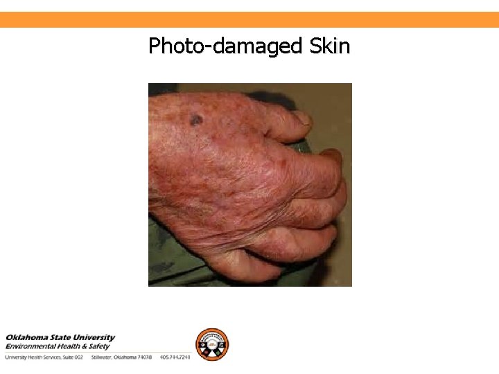 Environmental Health and Safety Photo-damaged Skin 