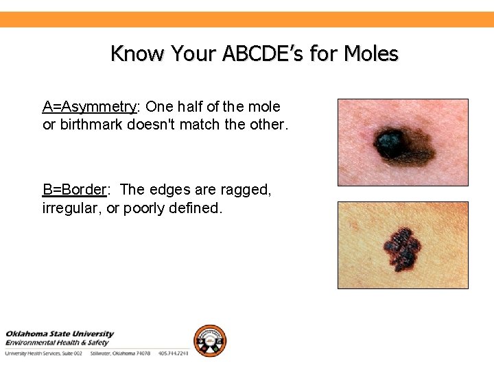 Environmental Health and Safety Know Your ABCDE’s for Moles A=Asymmetry: One half of the