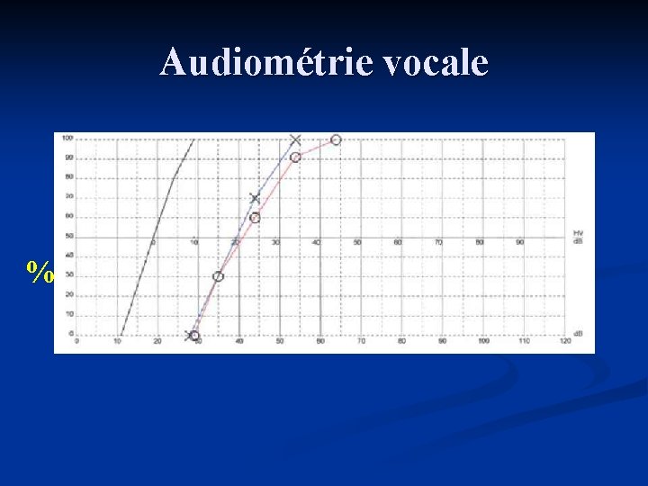 Audiométrie vocale % 