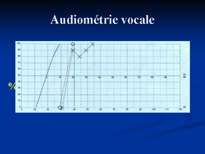 Audiométrie vocale % 