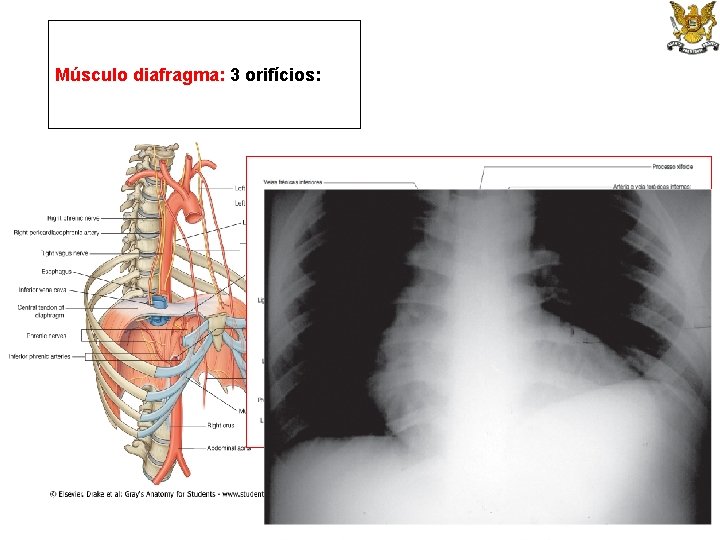 Músculo diafragma: 3 orifícios: 