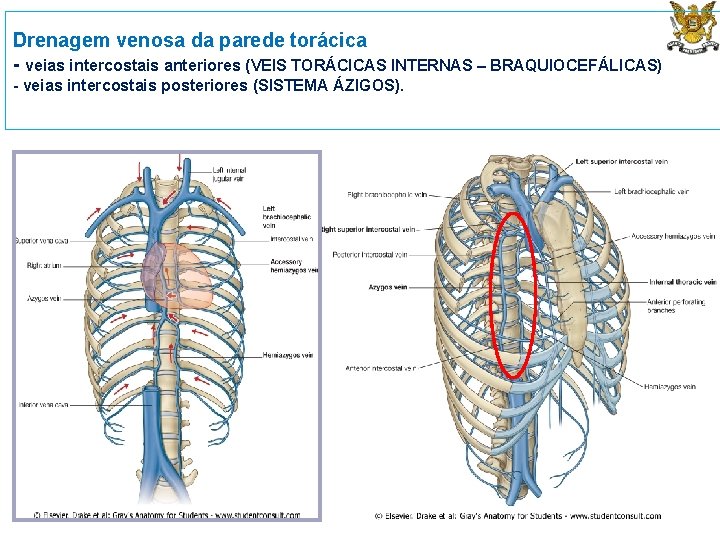 Drenagem venosa da parede torácica - veias intercostais anteriores (VEIS TORÁCICAS INTERNAS – BRAQUIOCEFÁLICAS)